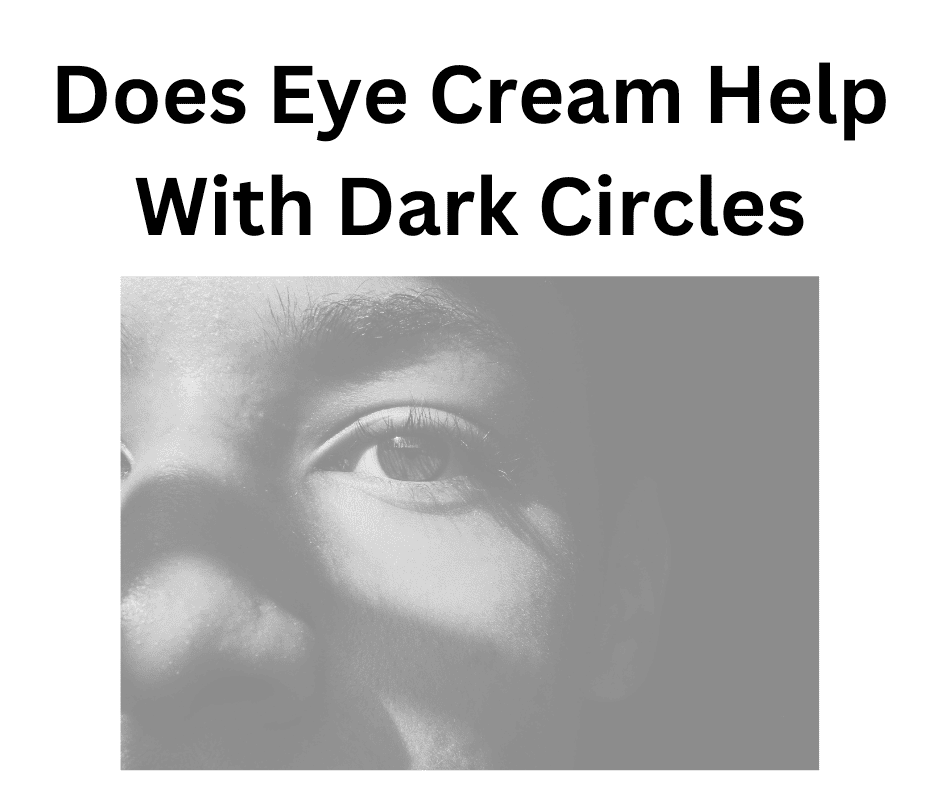 Does Eye Cream Help With Dark Circles